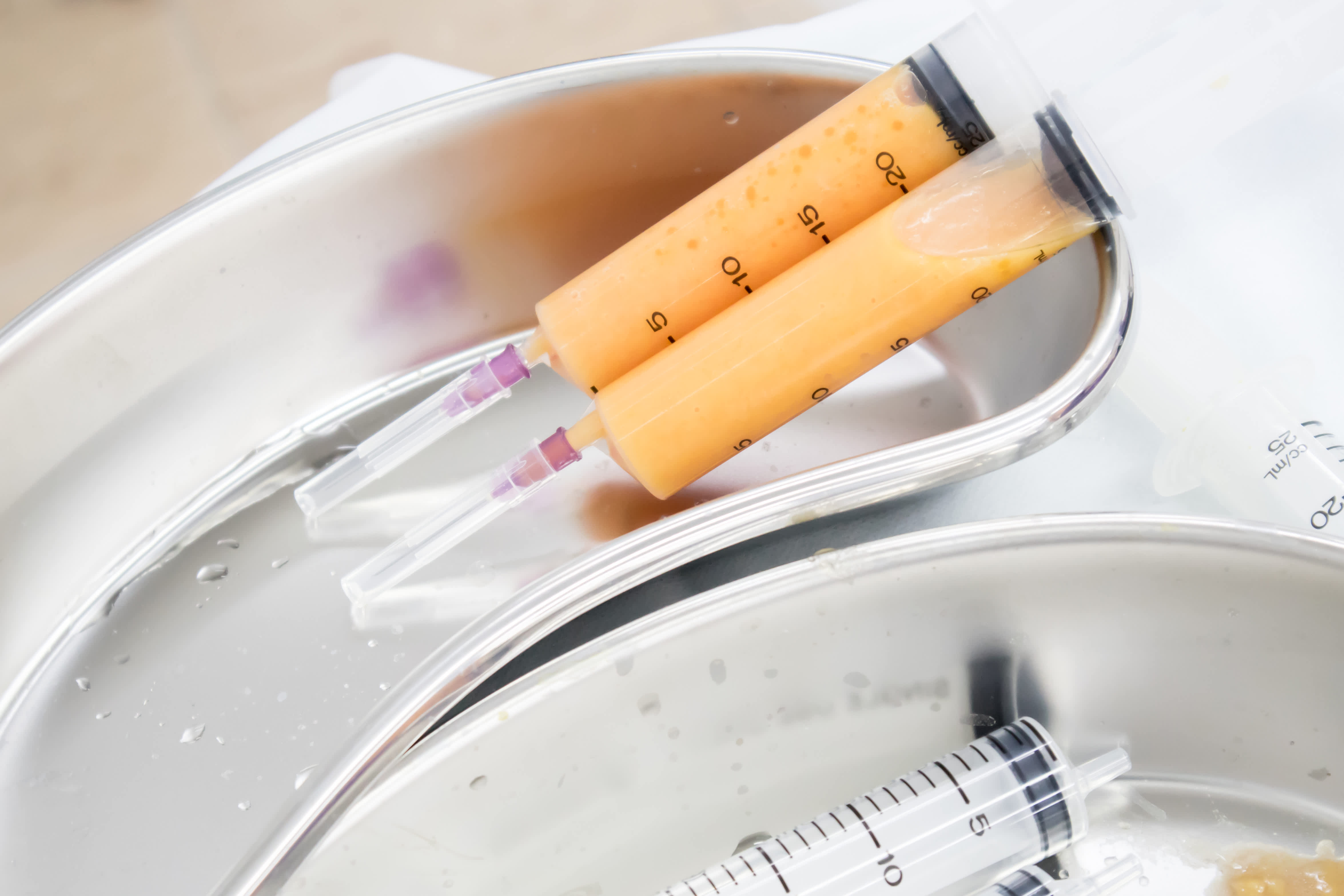 Regenerative Therapies Procedures Inland Pain Specialists