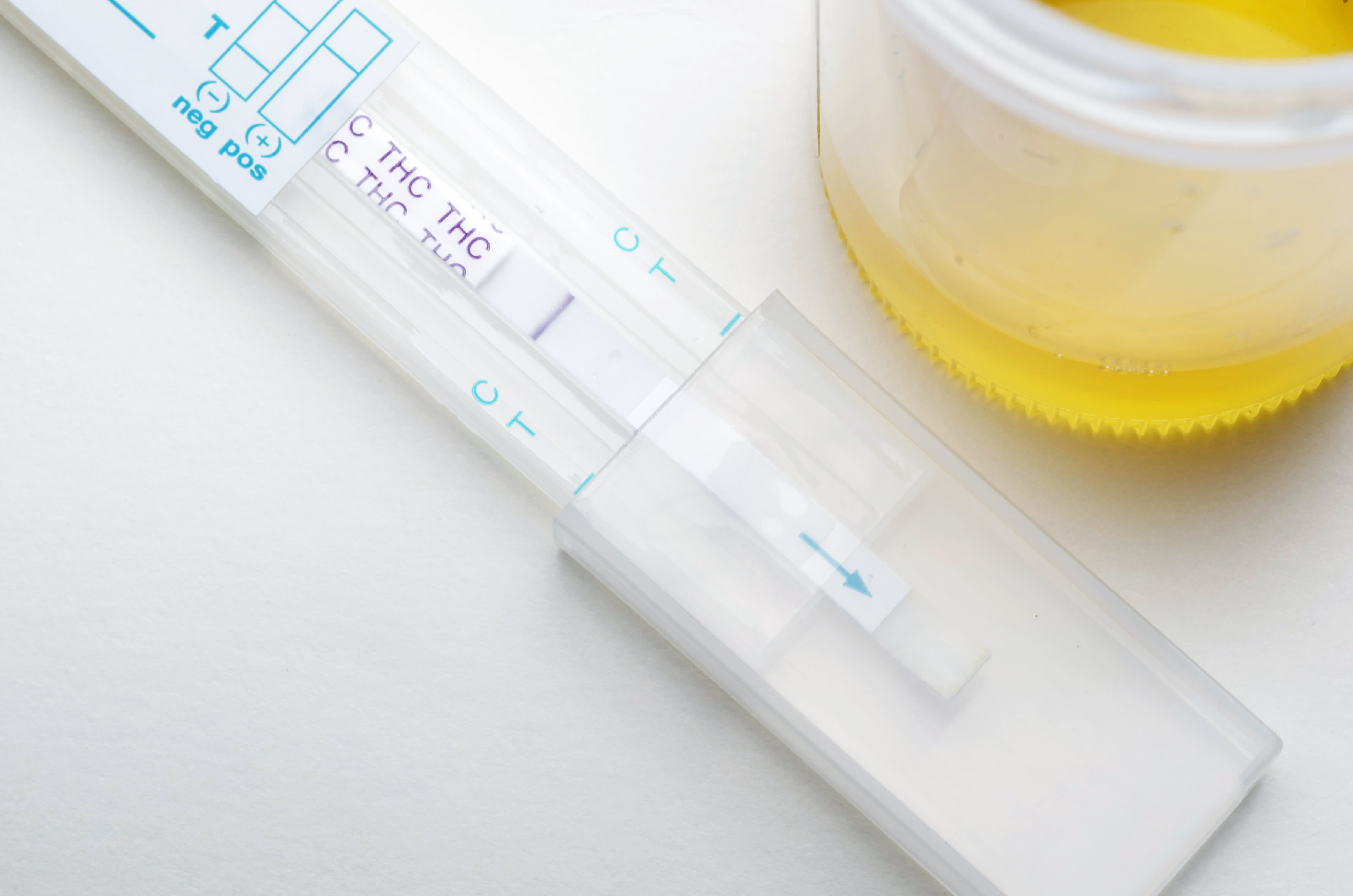 The Ultimate Guide To Fm 590Pp Non Dot Urine Testing - g0i7jnw
