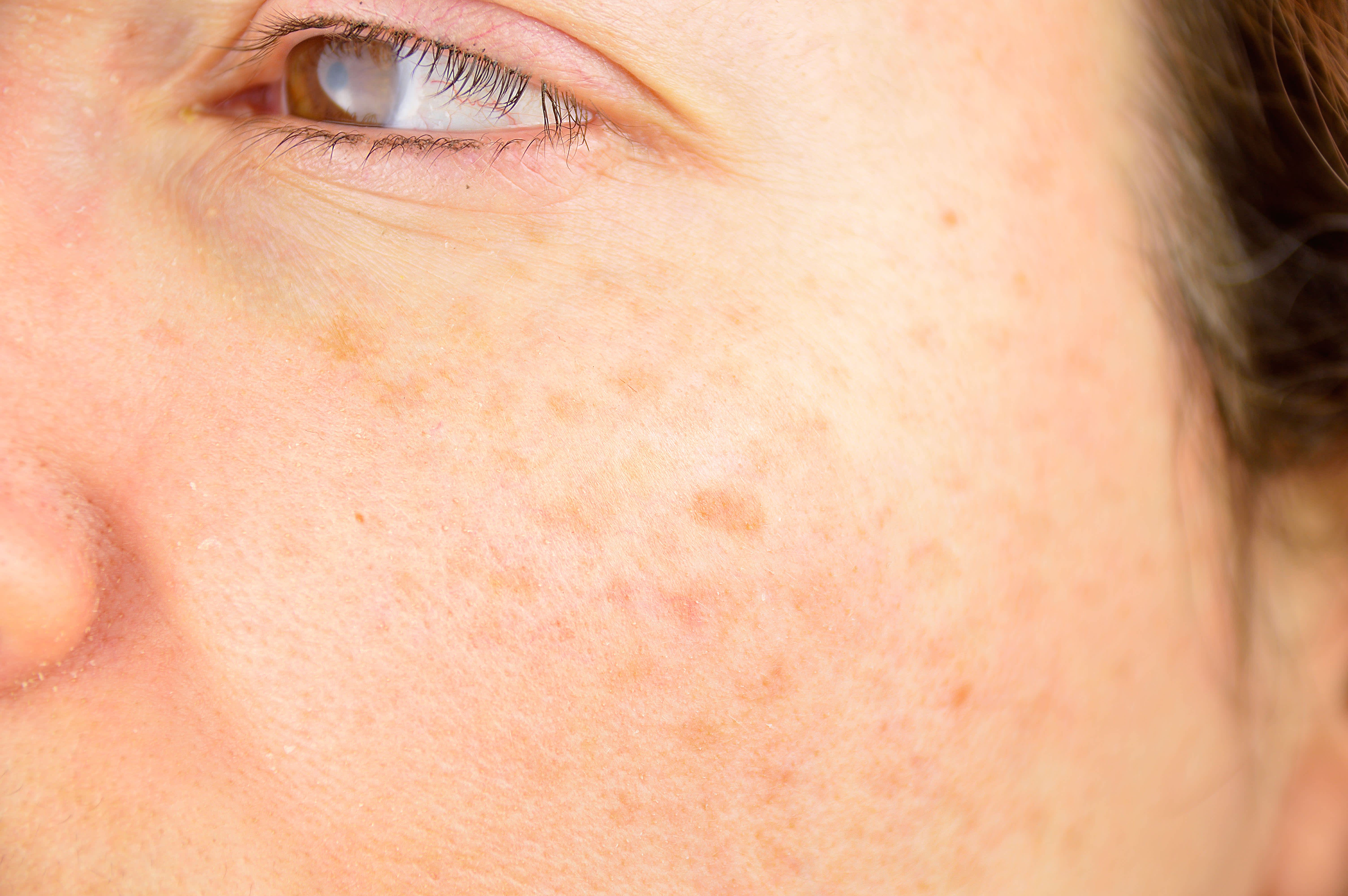 how do i know if my glutathione is low Signs of and Low Hormone Levels 9 Health Benefits of Glutathione