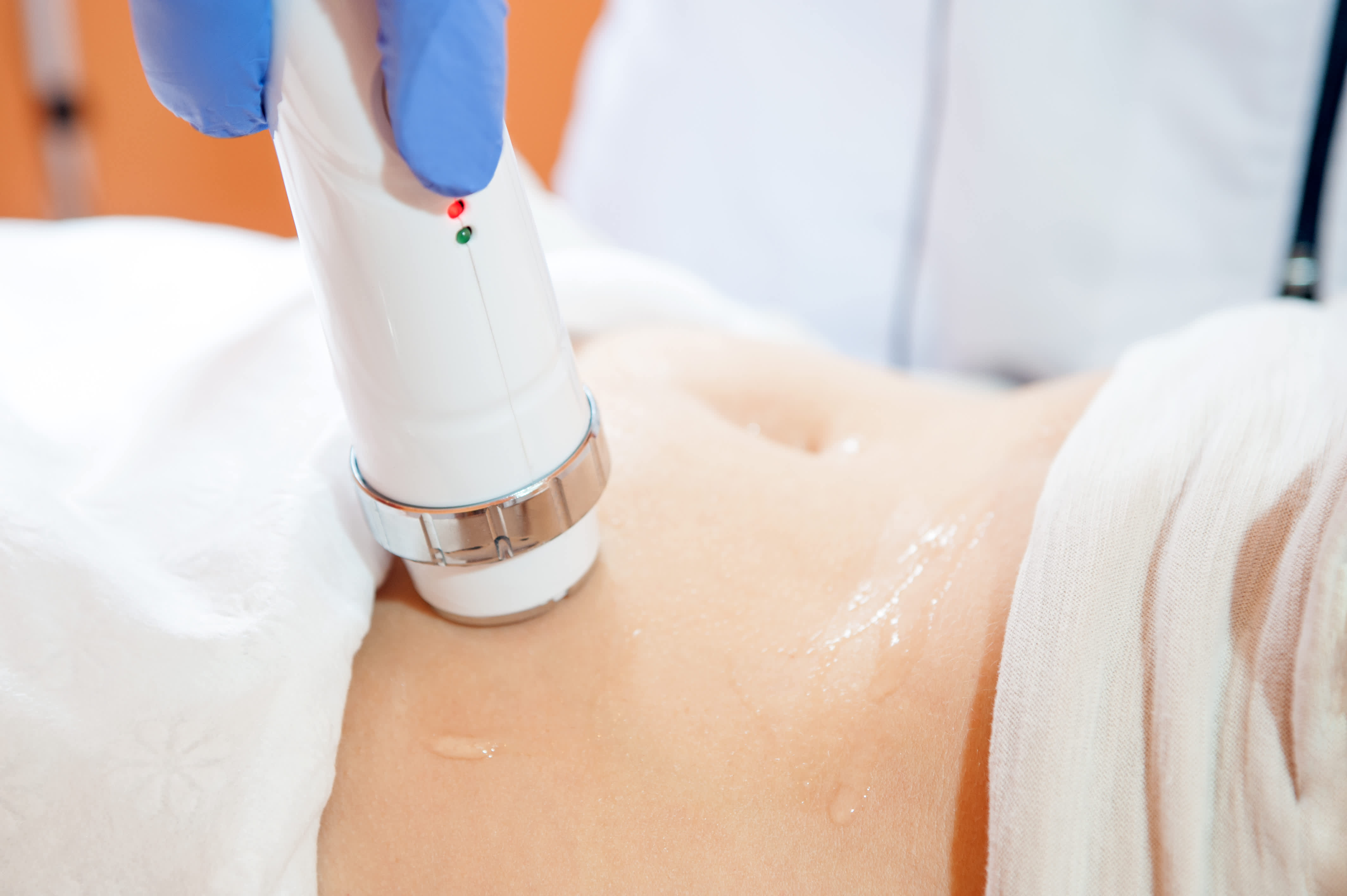 Ultrasound Cavitation - Florida Cosmetic Center