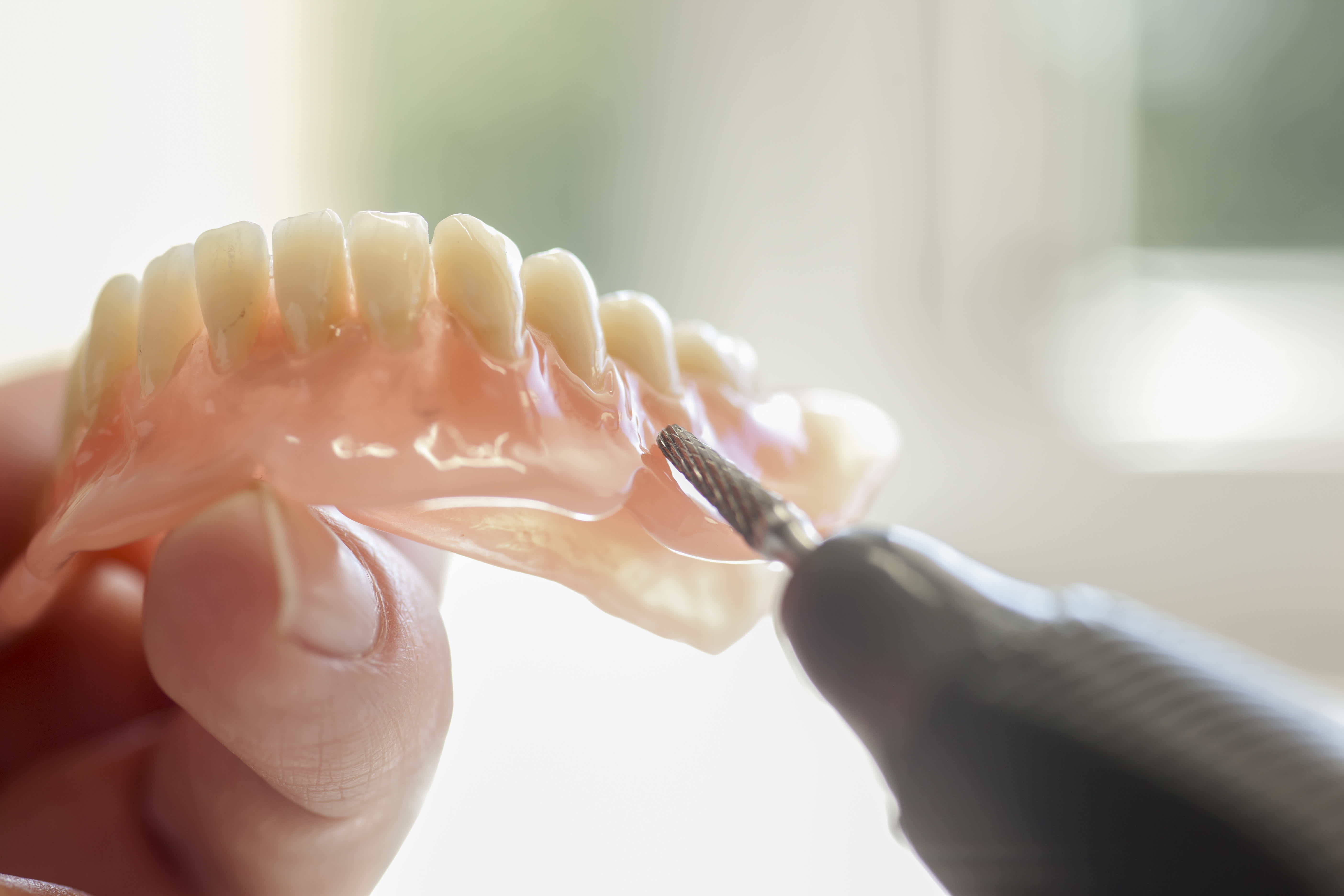 Трещина в протезе. Что такое иммедиат протез в стоматологии. Несъемные иммедиат-протезы.
