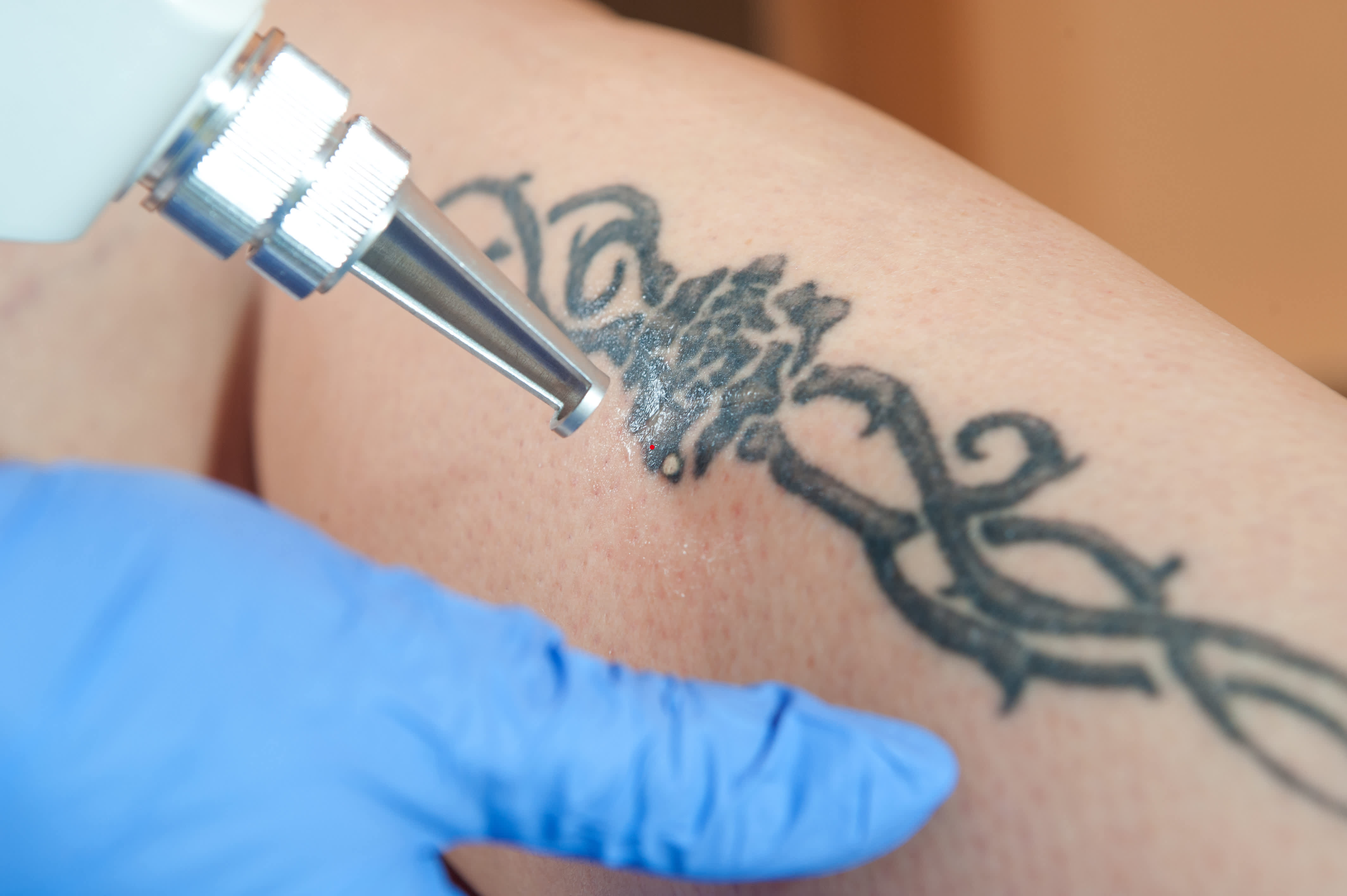 How Much of Your Medical History Should Tattoo Artists Know?