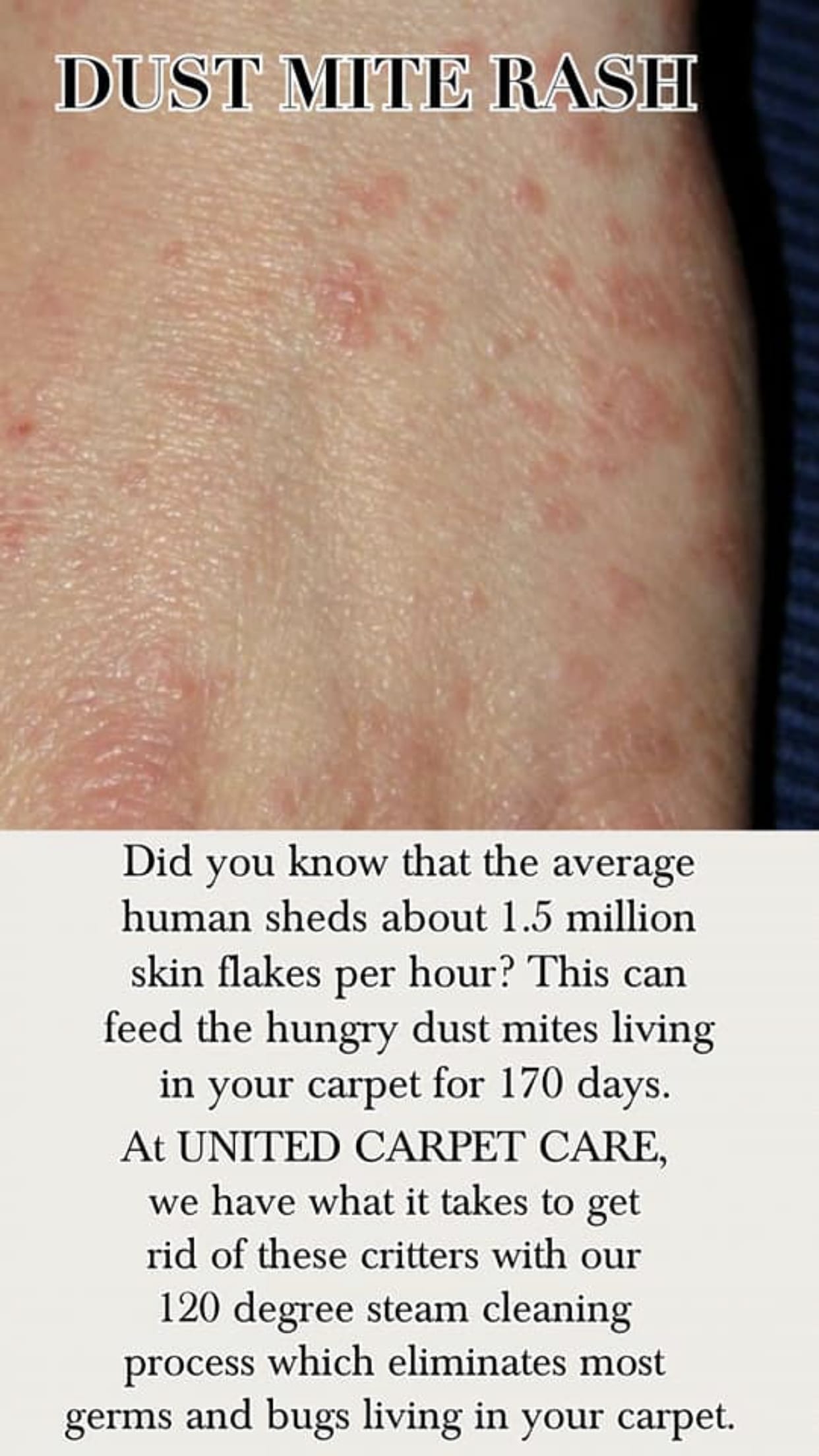 Rash After Carpet Cleaning Carpet Vidalondon