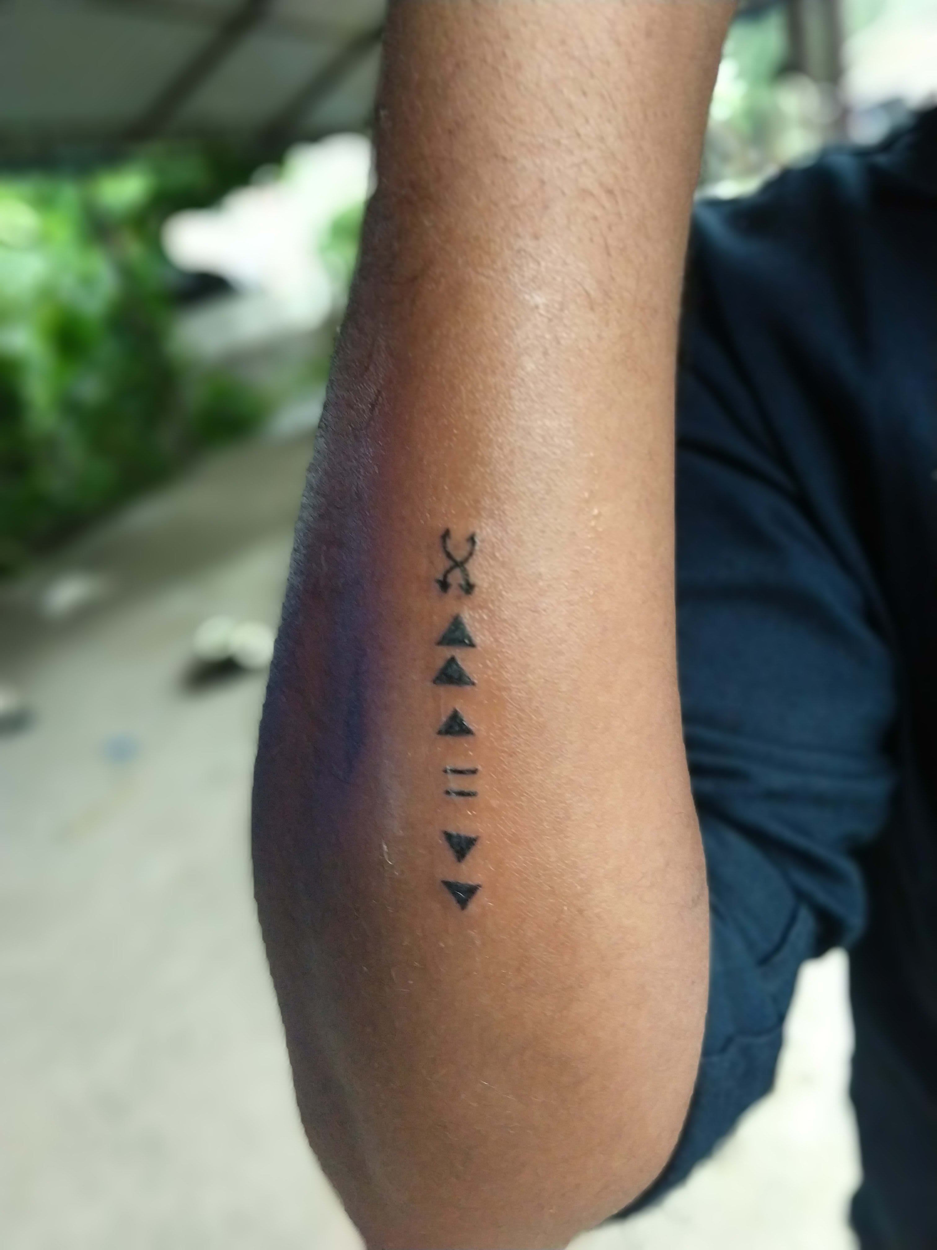 Man's play button tattoo almost creates huge surgical mishap | Metro News