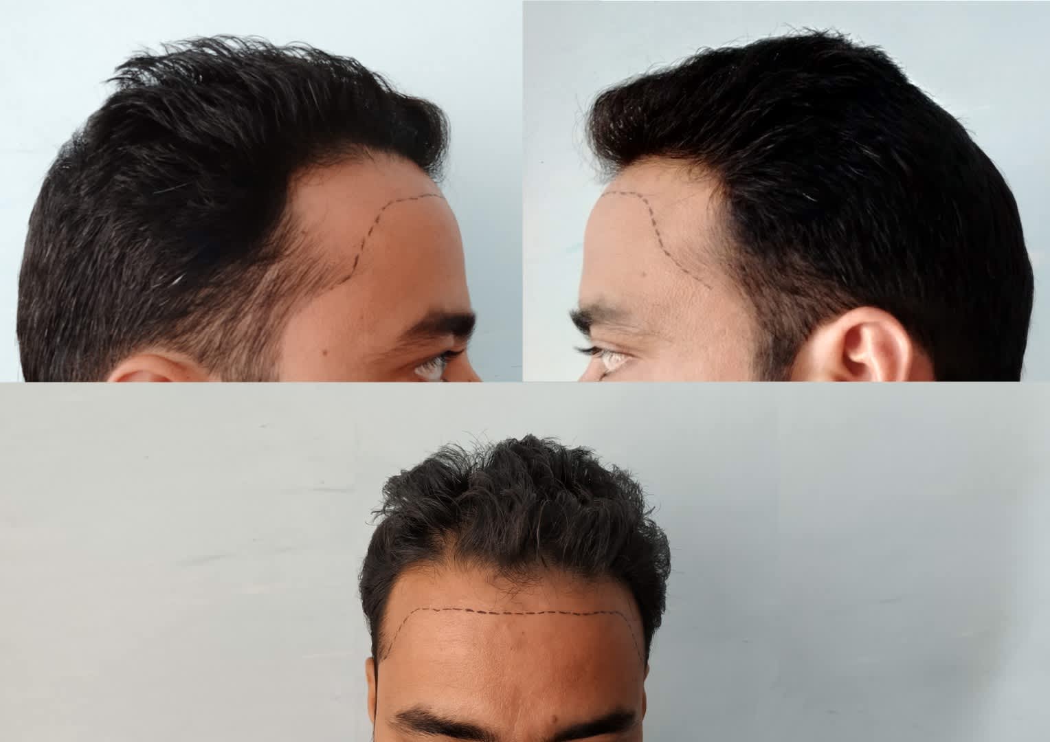 Trying to find a Hair Clinic in Alderley Edge? 