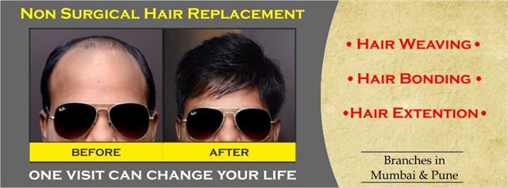 Non Surgical Hair Replacement - We Offer - Tp Hairstudio - Hair Replacement | Pune Non Surgical Hair Replacement - We Offer - Tp Hairstudio - Hair Replacement | Pune
