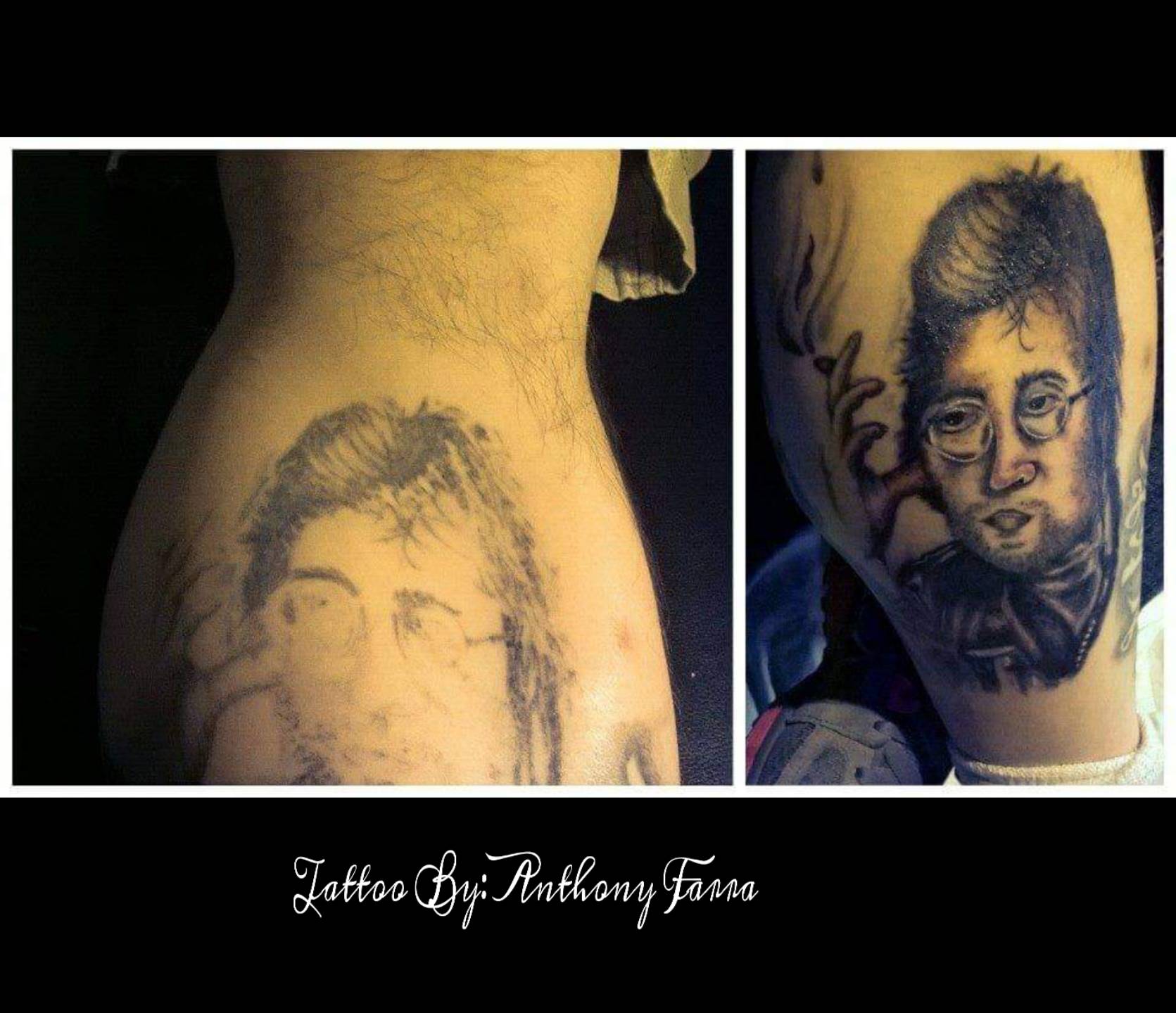 Tattoo Removal Peoria Il  Tattoo Removal Done Right