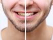 Salud y Estética Dental