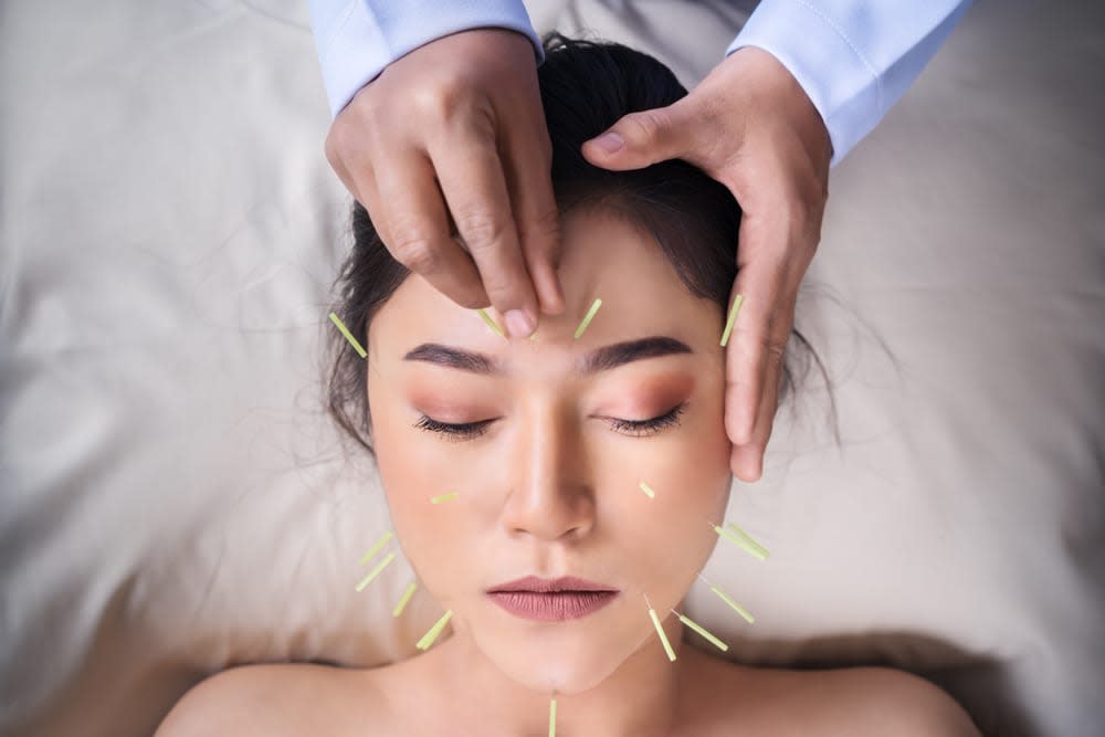 How does it work? FAQ AAHOM Acupuncture Acupuncturist Charlotte