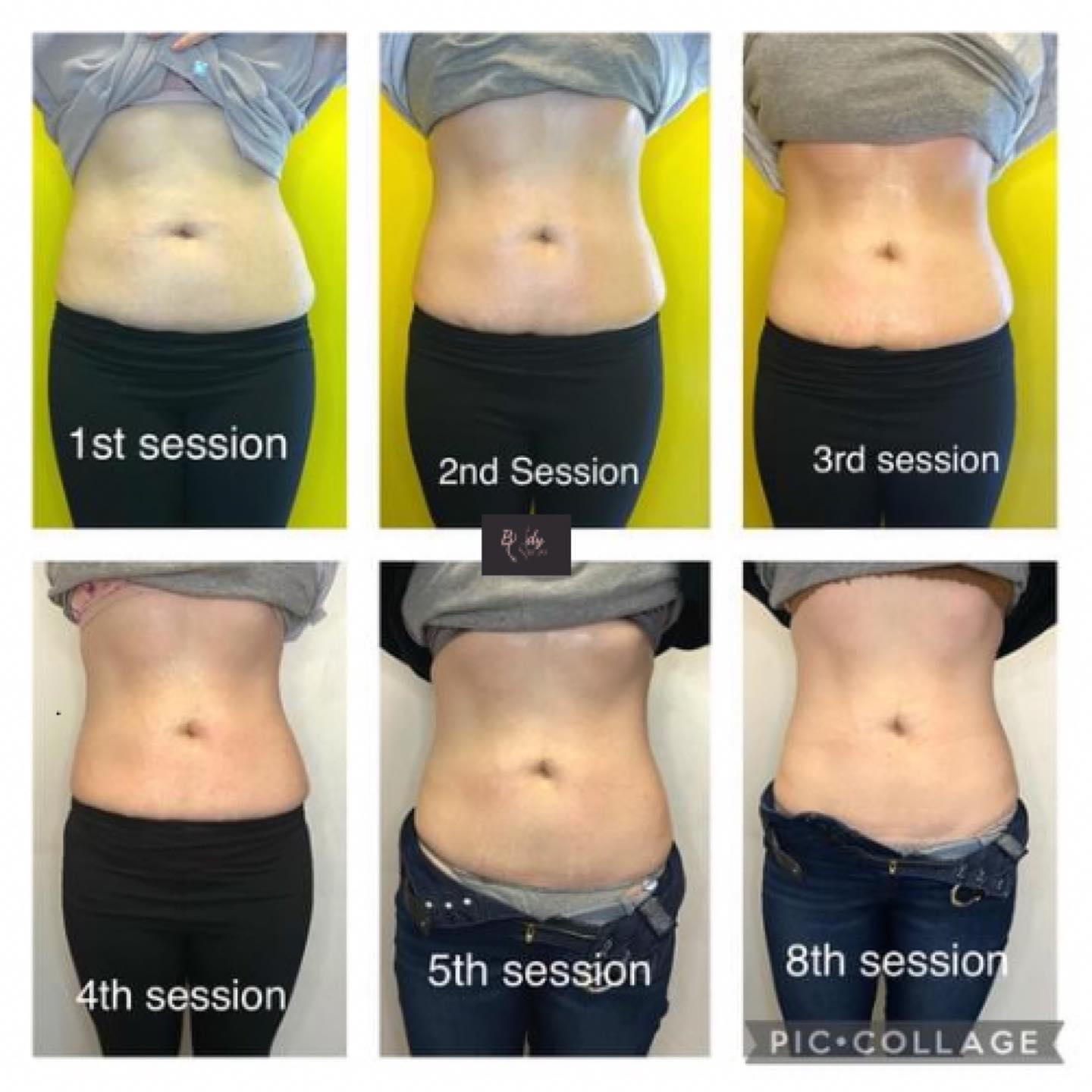 Eves Body Organic MedSpa - Before and After Bra line Lipo Cavitation  sessions 😍. $60 per session or 4 for $199 #workinprogress #lipocavitation  #jaxbeach #flemingisland