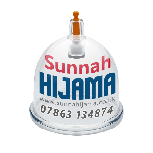 Sunnah Hijama
