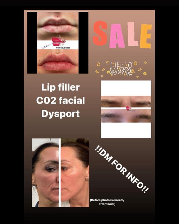 Lipo-Mino Injection - Fat Burning, Energy & Appetite Suppressant