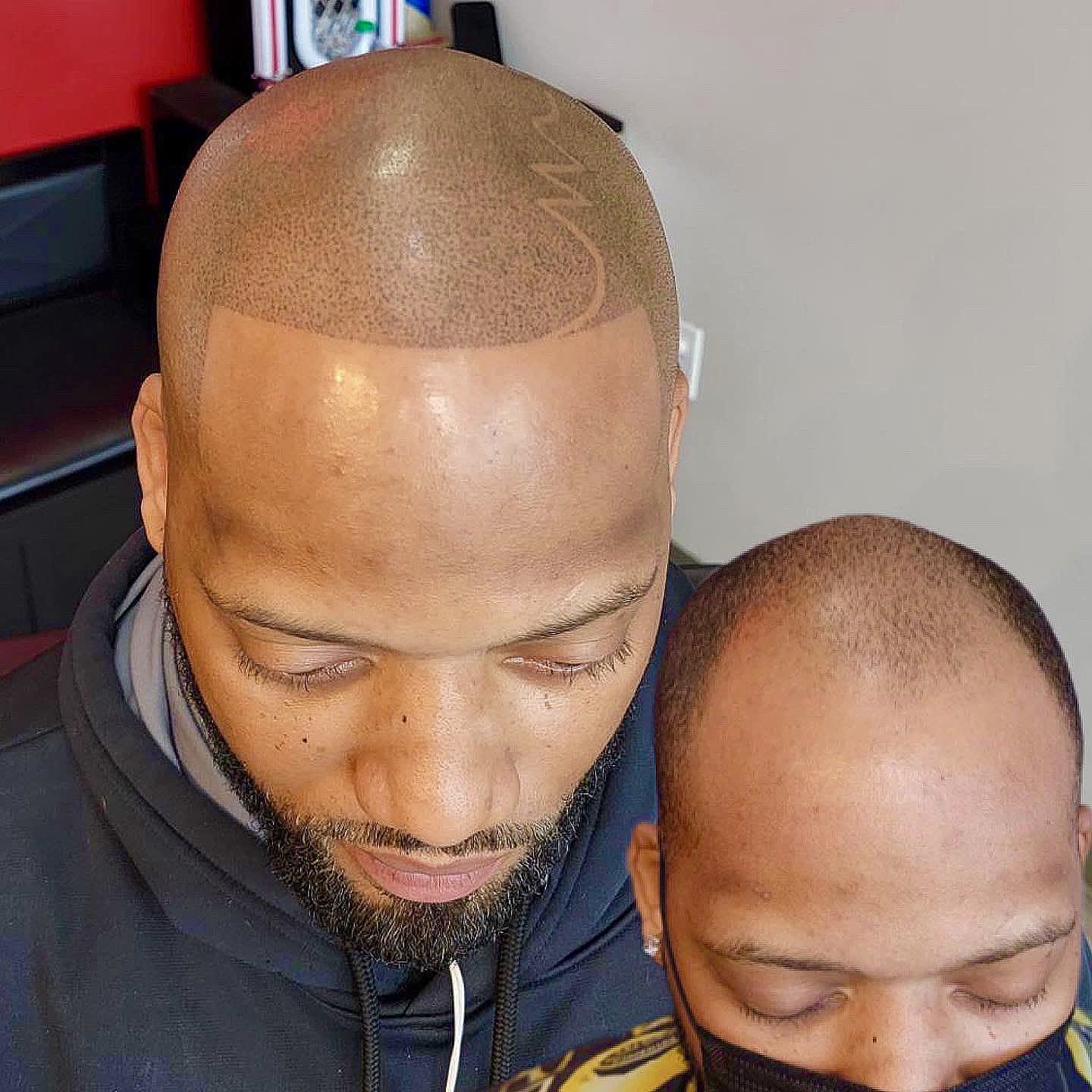 Scalp Micropigmentation (SMP) Micropigmentation Services Barber Ink
