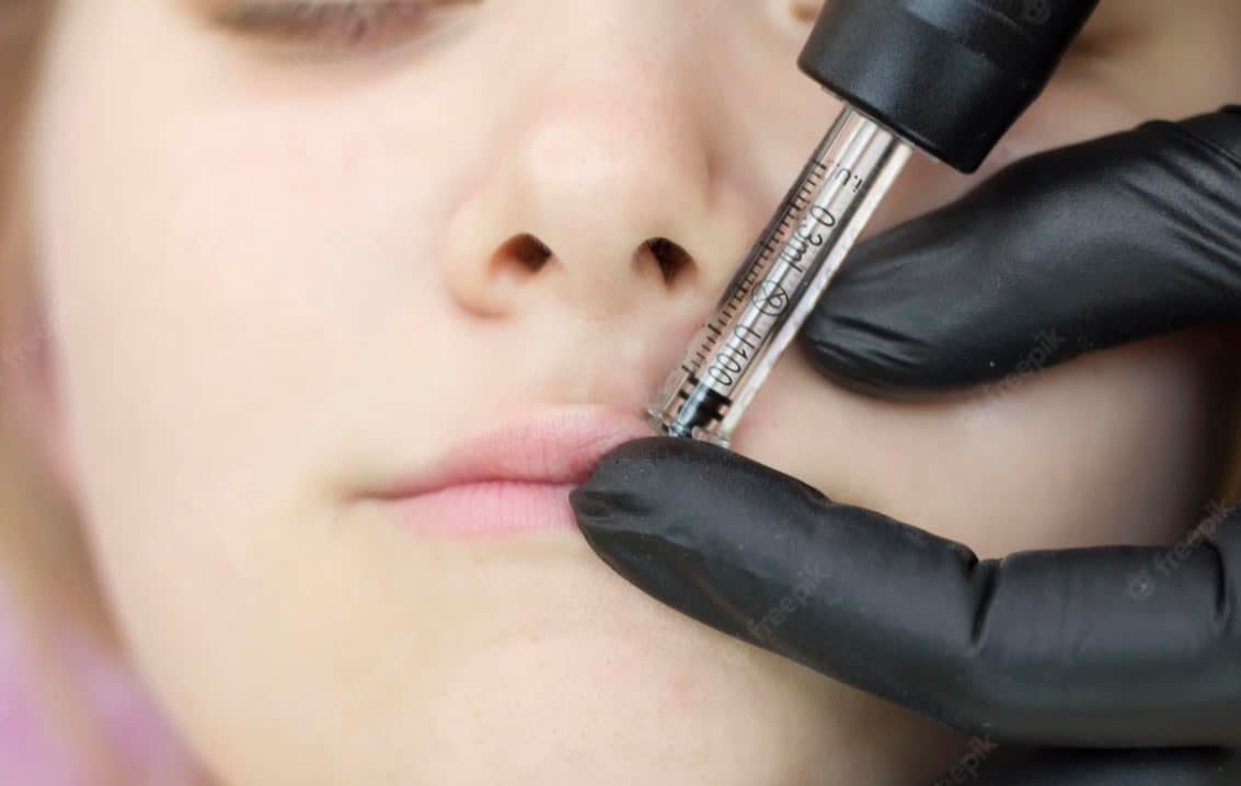 No Needle Lip Filler Hyaluron Pen No Needle Fillers Beautivu