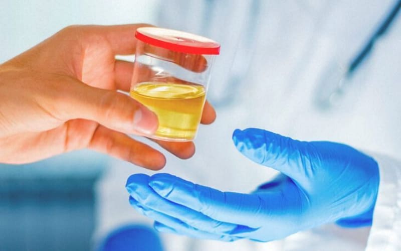 10 Panel Drug Test (Urine) Drugs of Abuse Drug Screening Covenant