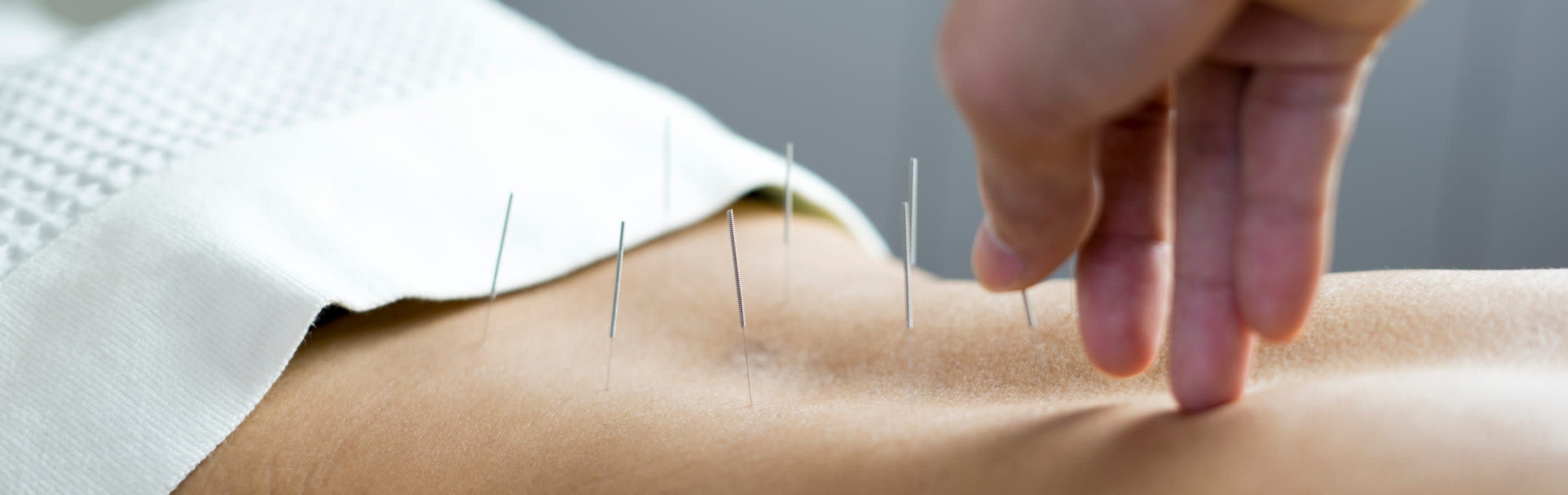 New Leaf Acupuncture Alternative Medicine Acupuncture in Redding New Leaf Acupuncture Alternative Medicine Acupuncture in Redding