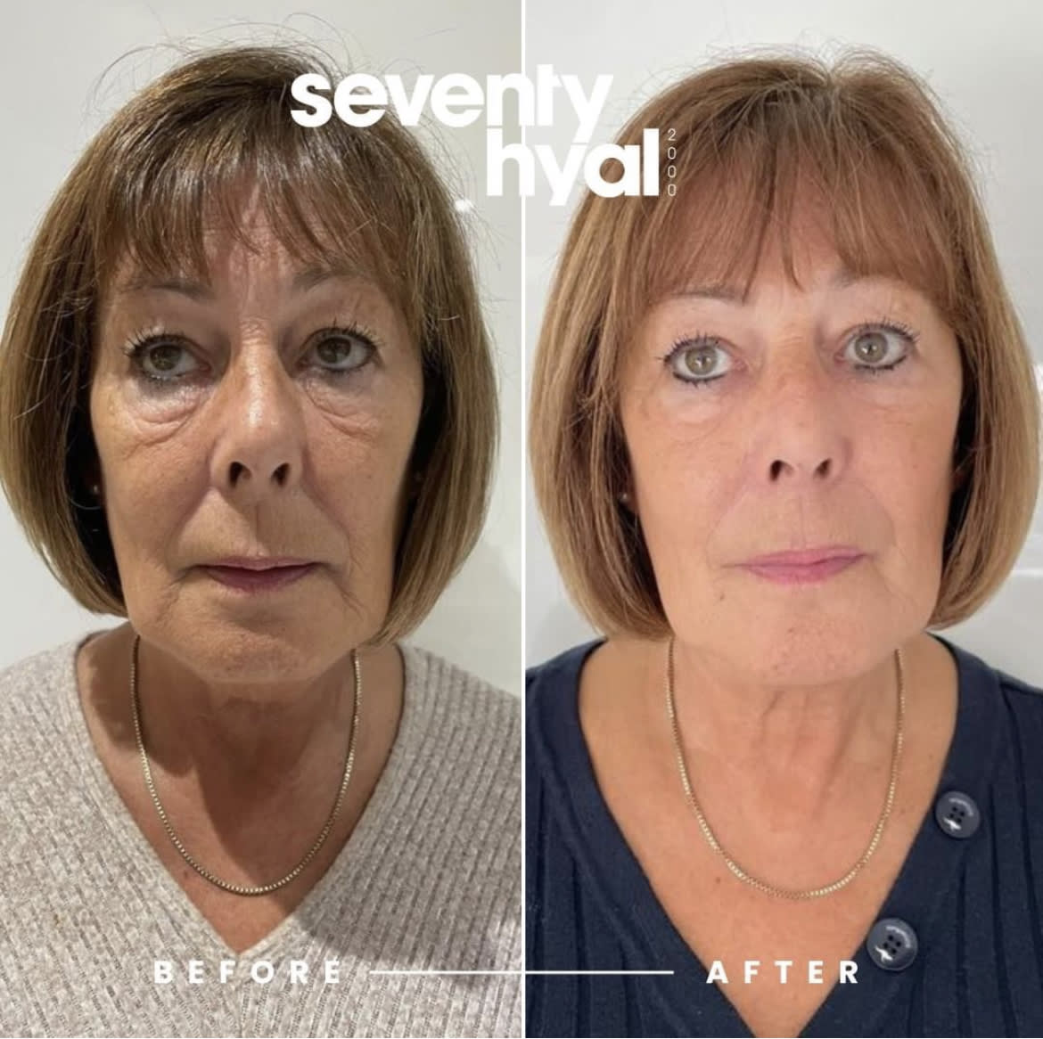 Youthful Glow Aesthetic Packages Glamourama Beauty Boutique