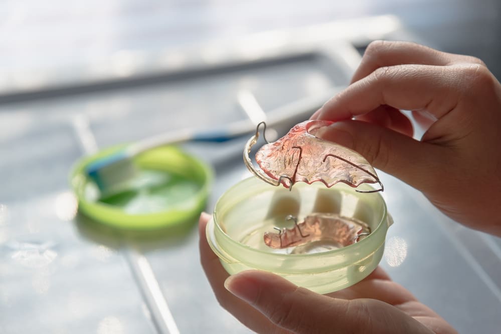 Upper and Lower Hawley's - Retainers - Acrylic Designs Dental Lab ...