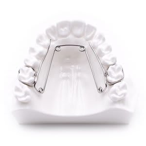 Quad-Helix - Functional Appliances - Acrylic Designs Dental Lab ...