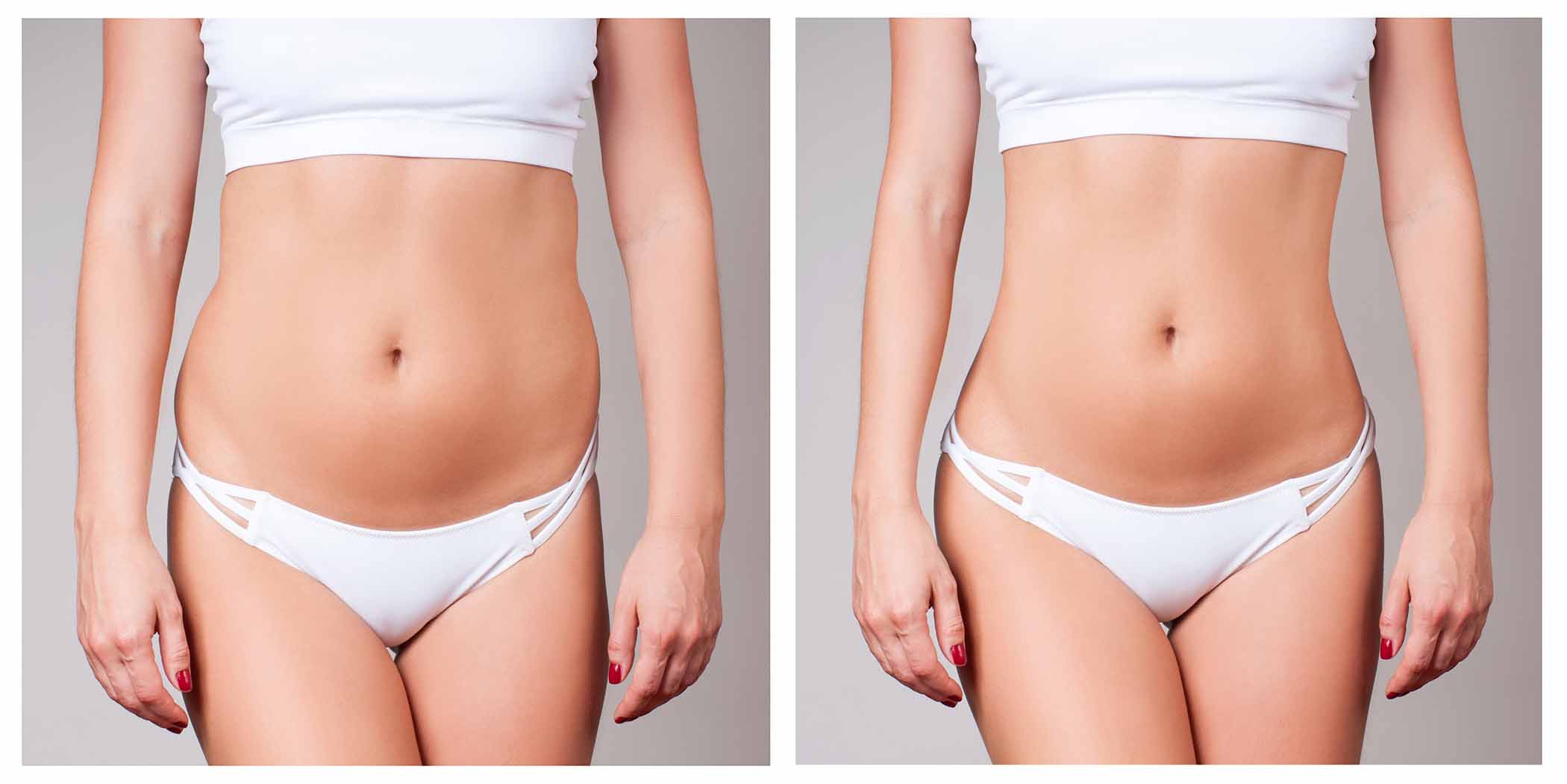 Ultrasonic Cavitation - Body Sculpting Treatments - GeoBri Aesthetics -  Best beauty salon in Llanfairfechan