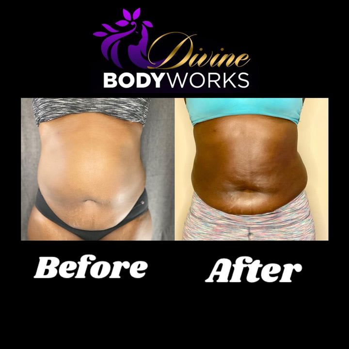 Divine Body Works LLC Post Op Recovery and Wellness Spa Bellflower