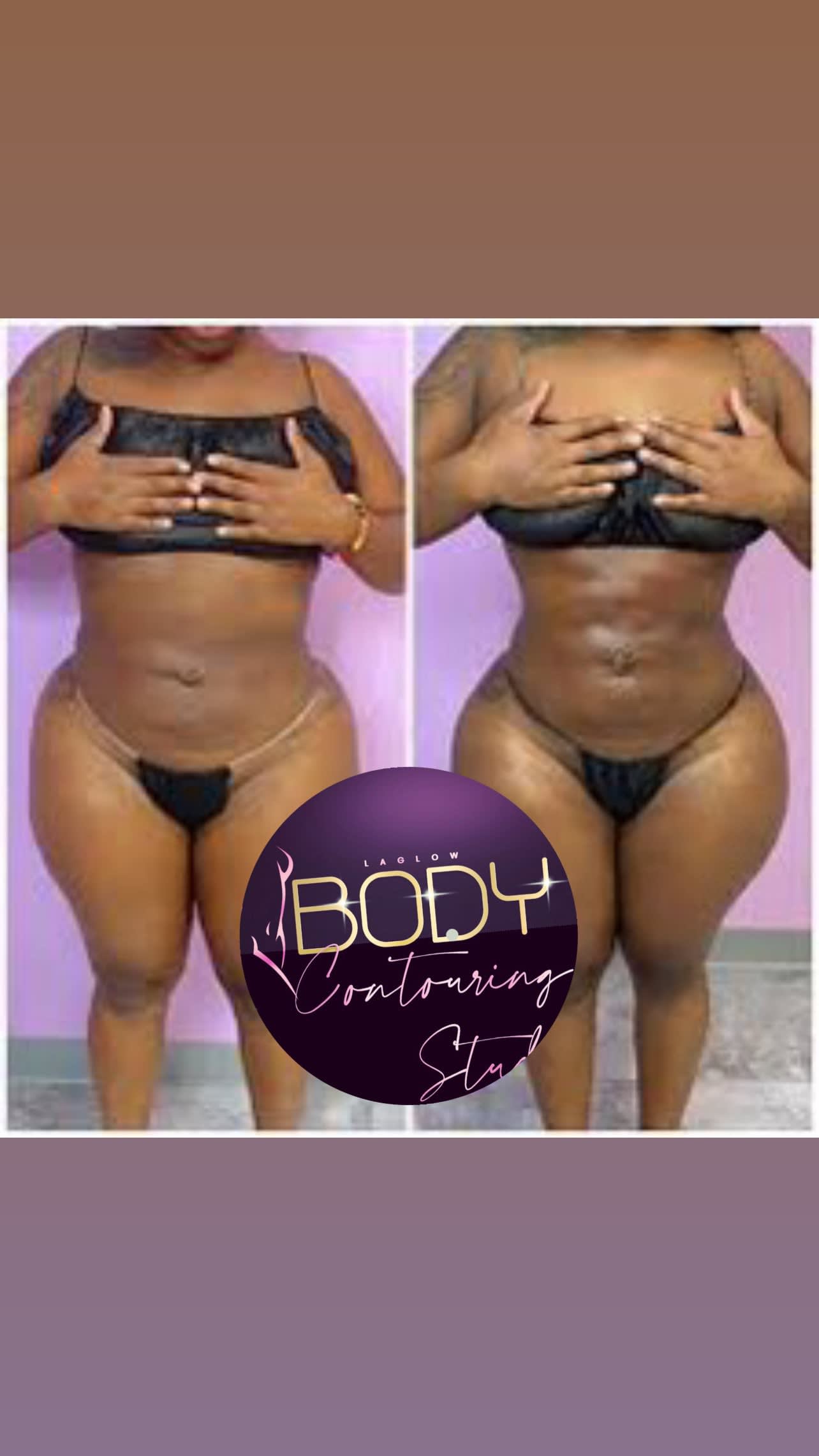 Body Contouring Near Me in Southampton, PA, and Langhorne, PA