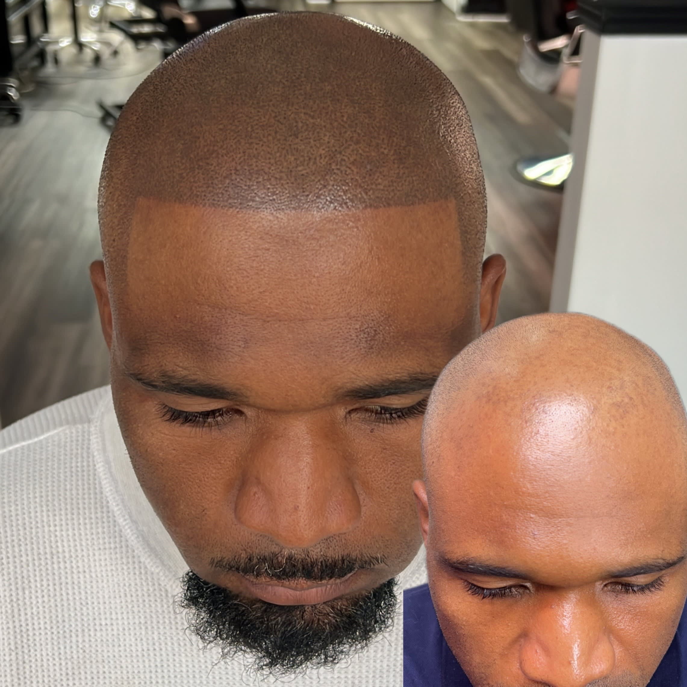Scalp Micropigmentation (SMP) Micropigmentation Services Barber Ink