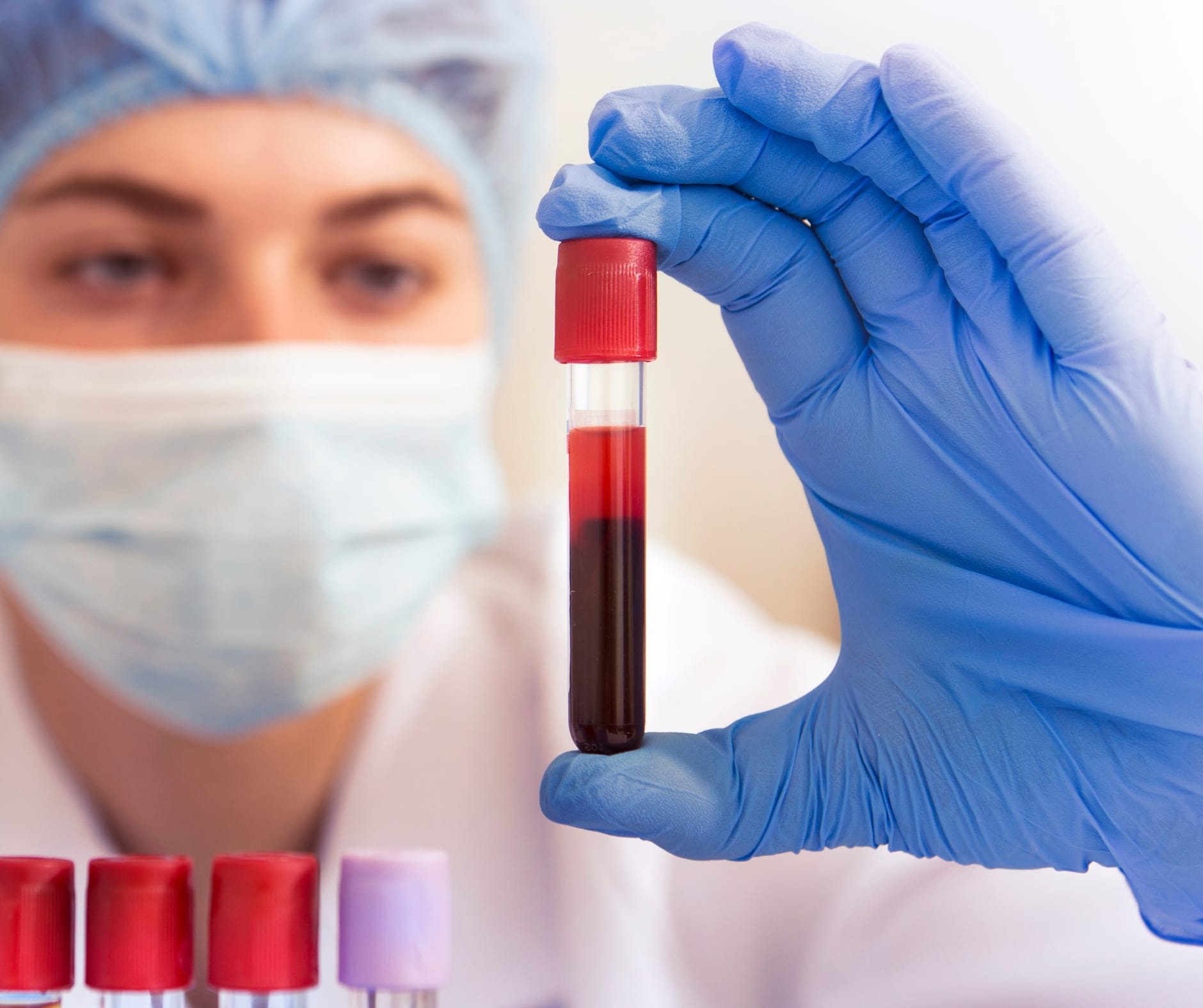 VeniPuncture Clinical Lab Testing Medical Lab Zoom Wellness Labs
