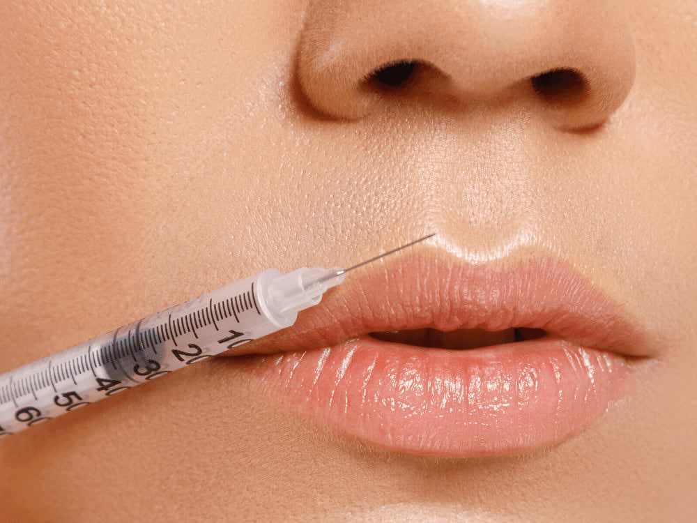 botox injectons for lips n.c Lip Flip vs Lip Fillers in Charlotte, NC: Which Is Right You? Dilworth Facial Plastic Surgery Lip flip or lip filler