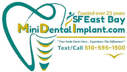 SF East Bay Area Mini Dental Implants