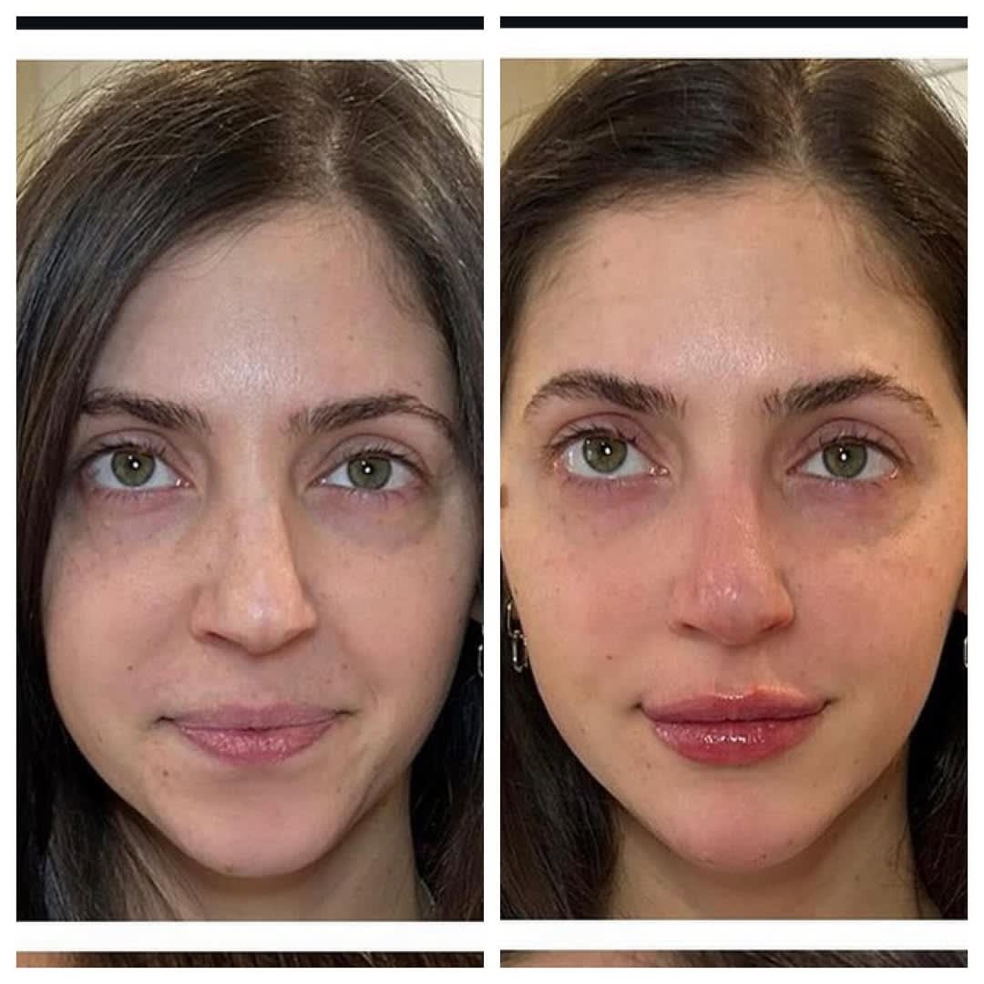 Semaglutide Injections - Skin & Wellness - BARDOT Boutique Aesthetics |  Medical Spa