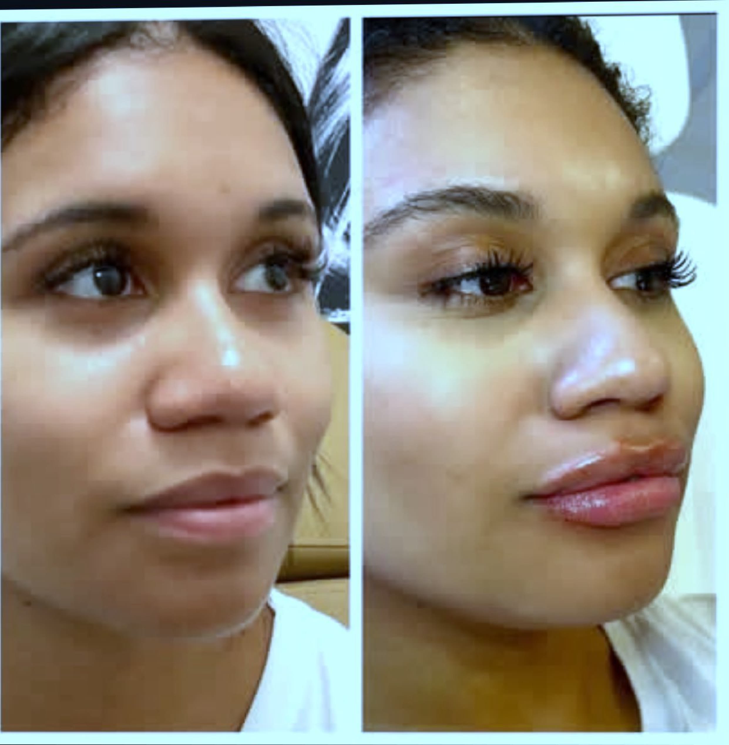 how do i inject semaglutide How to Inject Semaglutide