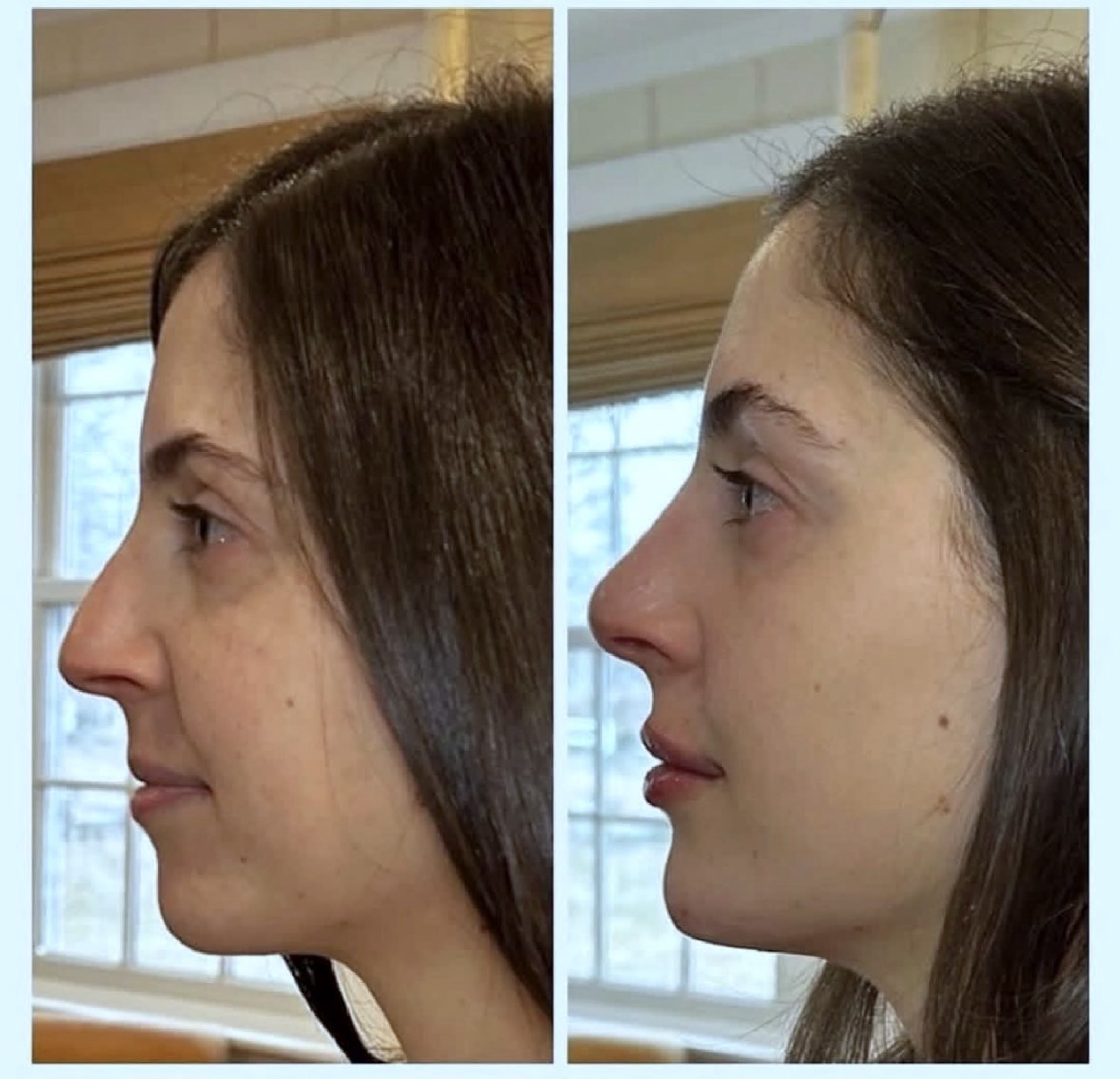 tirzepatide muscle twitching Tirzepatide Injections for Medical Weight Loss in Fayetteville NC