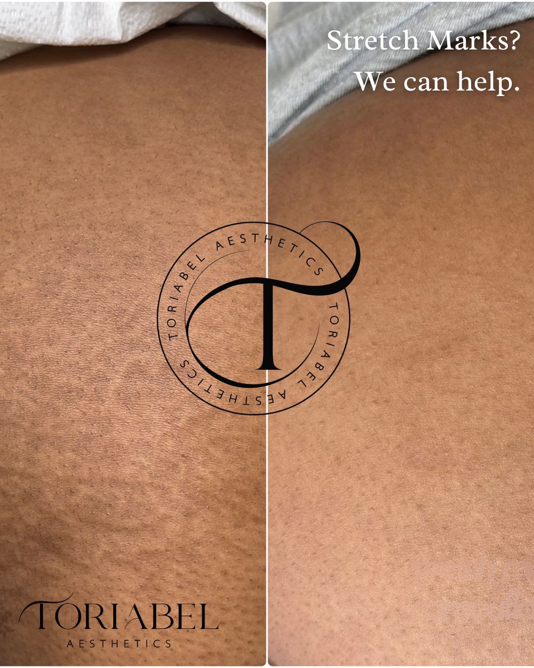 Toriabel Aesthetics client work