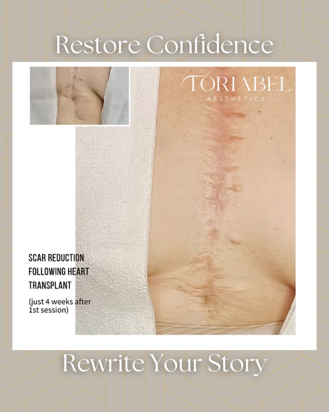 Toriabel Aesthetics client work