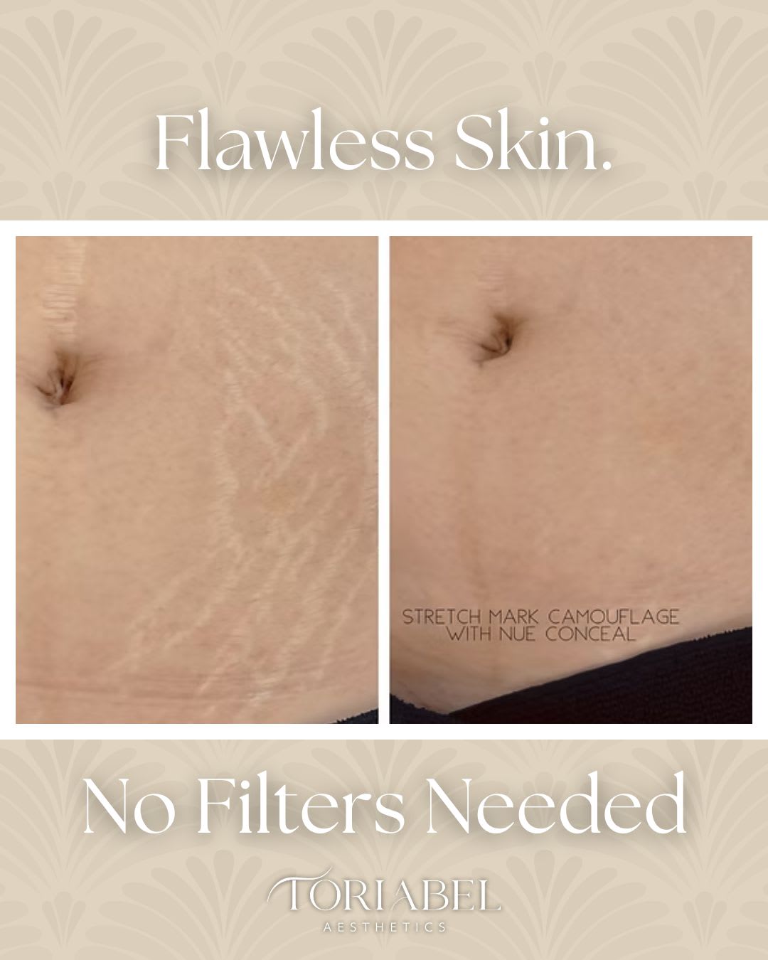 Toriabel Aesthetics client work