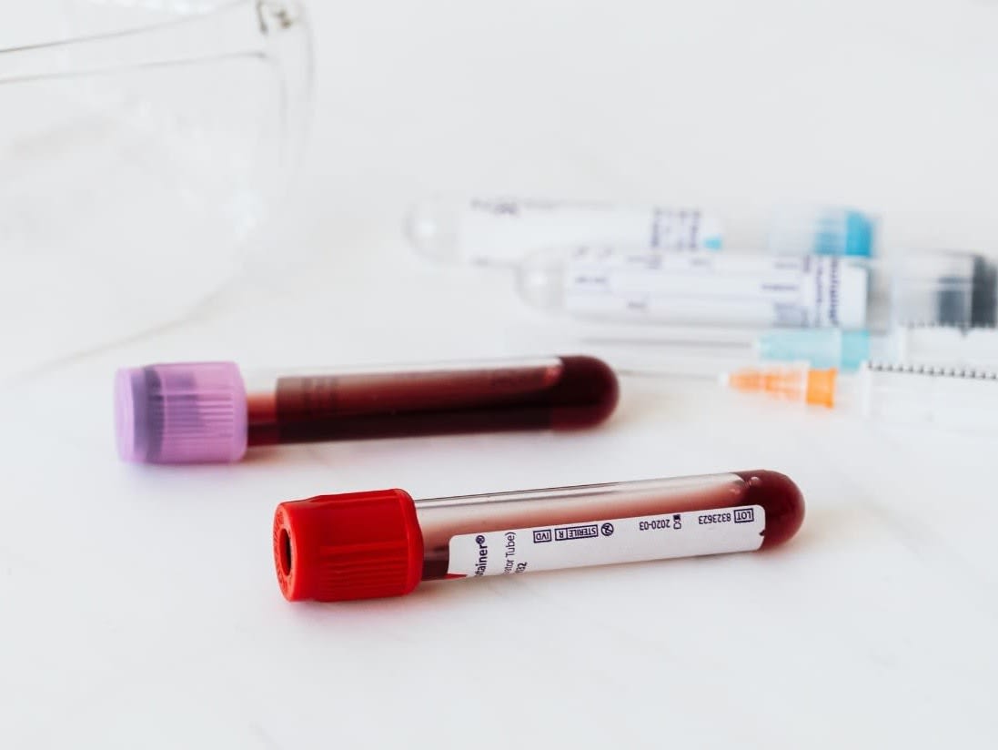 Uninsured Lab Testing in Boca Raton: How to Get Affordable Same-Day Testing