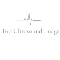 Top Ultrasound Image