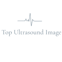Top Ultrasound Image