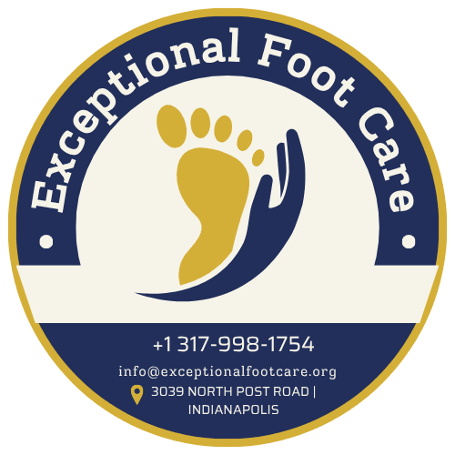 Exceptional Foot Care